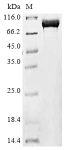 Greater than 90% as determined by SDS-PAGE.Recombinant Middle East Respiratory Syndrome-Related Coronavirus Orf1Ab