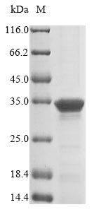 Greater than 85% as determined by SDS-PAGE.Recombinant Mycoplasma Pneumoniae Adp-Ribosylating Toxin Cards (MPN_372) Protein (His&Myc)