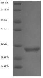 Greater than 90% as determined by SDS-PAGE.Recombinant Enterobacteria Phage H19B Shiga-Like Toxin 1 Subunit B (STXB) Protein (His-SUMO)