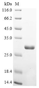 Greater than 90% as determined by SDS-PAGE.Recombinant E.Coli Peptidyl-Lysine N-Acetyltransferase Patz (PATZ) Protein (His&Myc)