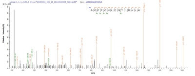 Based on the SEQUEST from database of E.coli host and target protein, the LC-MS/MS Analysis result of this product could indicate that this peptide derived from E.coli-expressed Helicobacter pylori (Campylobacter pylori) cagA.Recombinant Helicobacter Pylori Cytotoxicity-Associated Immunodominant Antigen (CAGA) Protein (His-SUMO)
