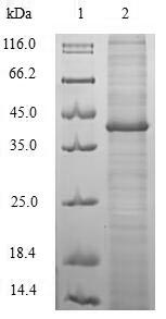 Greater than 90% as determined by SDS-PAGE.Recombinant Helicobacter Pylori Cytotoxicity-Associated Immunodominant Antigen (CAGA) Protein (His-SUMO)