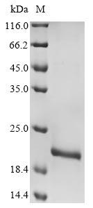 Greater than 90% as determined by SDS-PAGE.Recombinant Human Adenovirus C Serotype 2 Early E3 18.5 Kda Glycoprotein Protein (His&Myc)