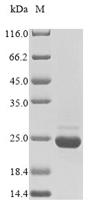 Greater than 85% as determined by SDS-PAGE.Recombinant Mycoplasma Pneumoniae Protein P200 (P200) Protein (His&Myc)