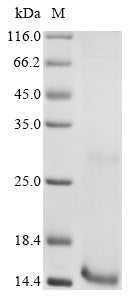 Greater than 90% as determined by SDS-PAGE.Recombinant Plasmodium Falciparum Gametocyte Surface Protein P230 (PFS230)