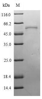 Greater than 90% as determined by SDS-PAGE.Recombinant Influenza A Virus Nucleoprotein (NP) Protein (His)
