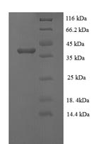 Greater than 90% as determined by SDS-PAGE.Recombinant Rabies Virus Phosphoprotein (P) Protein (His)