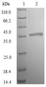 Greater than 90% as determined by SDS-PAGE.Recombinant E.Coli Murein Tetrapeptide Carboxypeptidase (LDCA) Protein (His)