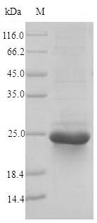 Greater than 90% as determined by SDS-PAGE.