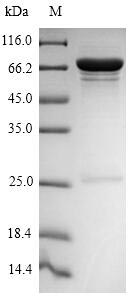 Greater than 90% as determined by SDS-PAGE.Recombinant Influenza A Virus Nucleoprotein (NP) Protein (His-SUMO)