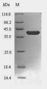 Greater than 90% as determined by SDS-PAGE.
