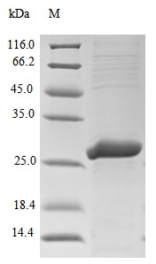 Greater than 85% as determined by SDS-PAGE.Recombinant Tick-Borne Encephalitis Virus Genome Polyprotein Protein (His-KSI)