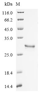 Greater than 90% as determined by SDS-PAGE.Recombinant Macrovipera Lebetina Obtusa Disintegrin Obtustatin Protein (GST)