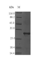 Greater than 90% as determined by SDS-PAGE.