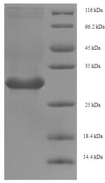 Greater than 90% as determined by SDS-PAGE.Recombinant Silene Chalcedonica Ribosome-Inactivating Protein Lychnin Protein (His)