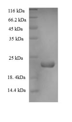 Greater than 90% as determined by SDS-PAGE.Recombinant Dactylis Glomerata Major Pollen Allergen Dac G 4 Protein (His-SUMO)