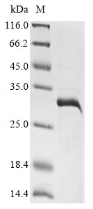 Greater than 85% as determined by SDS-PAGE.Recombinant Plasmodium Falciparum Reticulocyte-Binding Protein Pfd0110W (PFD0110W)