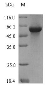 Greater than 90% as determined by SDS-PAGE.Recombinant Wheat Serpin-Z1B Protein (His-SUMO)