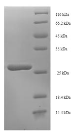 Greater than 90% as determined by SDS-PAGE.Recombinant Dactylis Glomerata Pollen Allergen Dac G 3 Protein (His-SUMO)