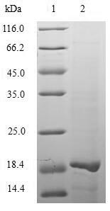 Greater than 90% as determined by SDS-PAGE.Recombinant Human Herpesvirus 2 Tegument Protein Vp22 (UL49) Protein (His)