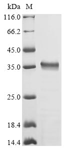 Greater than 85% as determined by SDS-PAGE.Recombinant Porphyromonas Gingivalis Gingipain R2 (RGPB) Protein (His)