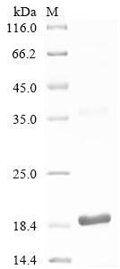 Greater than 90% as determined by SDS-PAGE.