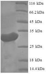 Greater than 90% as determined by SDS-PAGE.Recombinant Hepatitis C Virus Genotype 1A Genome Polyprotein Protein (His-SUMO)