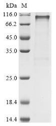 Greater than 85% as determined by SDS-PAGE.Recombinant Human 2-5A-Dependent Ribonuclease (RNASEL) Protein (GST)
