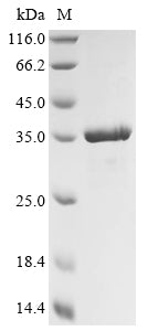 Greater than 90% as determined by SDS-PAGE.Recombinant Mannheimia Haemolytica Leukotoxin (LKTA) Protein (His&Myc)