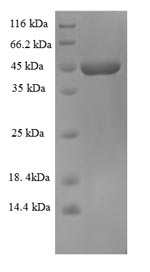 Greater than 90% as determined by SDS-PAGE.Recombinant Zaire Ebolavirus Super Small Secreted Glycoprotein (GP) Protein (His-SUMO)