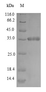 Greater than 90% as determined by SDS-PAGE.Recombinant Mycobacterium Smegmatis Dna Protection During Starvation Protein (DPS) Protein (His-SUMO)