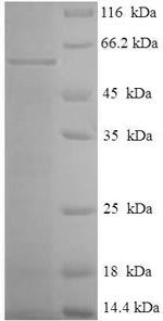 Greater than 90% as determined by SDS-PAGE.Recombinant Mycoplasma Hyopneumoniae 46 Kda Surface Antigen (P46) Protein (His-SUMO)
