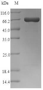 Greater than 90% as determined by SDS-PAGE.Recombinant Clostridium Perfringens Perfringolysin O (PFO) Protein (His-SUMO)