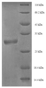 Greater than 90% as determined by SDS-PAGE.Recombinant Horse Myelin P2 Protein (PMP2) Protein (His-SUMO)