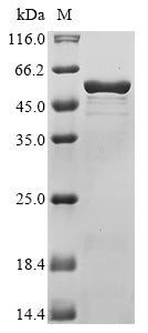 Greater than 85% as determined by SDS-PAGE.Recombinant Yersinia Pestis Virulence-Associated V Antigen (LCRV) Protein (His-SUMO&Myc)