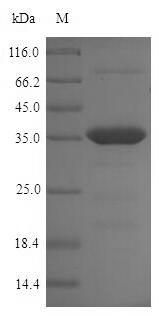Greater than 90% as determined by SDS-PAGE.Recombinant Chlamydia Trachomatis Large Cysteine-Rich Periplasmic Protein Omcb (OMCB) Protein (His-SUMO)