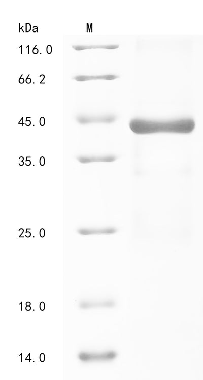 Greater than 85% as determined by SDS-PAGE.Recombinant Chlamydia Trachomatis Virulence Plasmid Protein Pgp3-D Protein (His-SUMO)