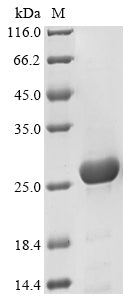 Greater than 85% as determined by SDS-PAGE.Recombinant Chlamydia Trachomatis Virulence Plasmid Protein Pgp3-D