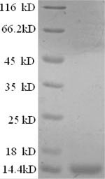 Greater than 90% as determined by SDS-PAGE.