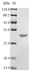 Greater than 90% as determined by SDS-PAGE.Recombinant Epstein-Barr Virus Secreted Protein Barf1 (BARF1) Protein (His)
