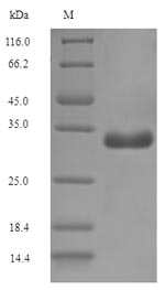 Greater than 90% as determined by SDS-PAGE.Recombinant E.Coli F17 Fimbrial Protein (F17A-A) Protein (His-SUMO)