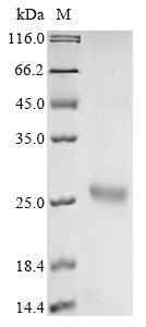 Greater than 90% as determined by SDS-PAGE.Recombinant Avian Infectious Bronchitis Virus Spike Glycoprotein (S) Protein (His)