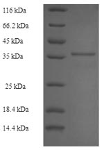 Greater than 90% as determined by SDS-PAGE.