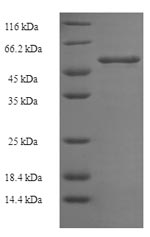 Greater than 90% as determined by SDS-PAGE.Recombinant Plasmodium Falciparum Multidrug Resistance Protein (MDR1) Protein (His-SUMO)