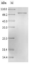 Greater than 90% as determined by SDS-PAGE.Recombinant Lassa Virus Nucleoprotein (N) Protein (His-SUMO)