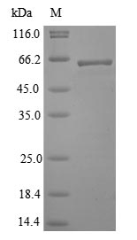 Greater than 85% as determined by SDS-PAGE.Recombinant Lassa Virus Nucleoprotein (N)