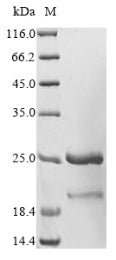 Greater than 85% as determined by SDS-PAGE.Recombinant Plasmodium Falciparum L-Lactate Dehydrogenase Protein (His-SUMO&Myc)