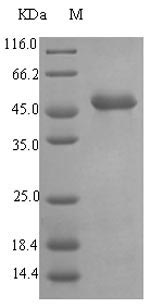 Greater than 90% as determined by SDS-PAGE.Recombinant Pseudomonas Aeruginosa Elastase (LASB) Protein (His-SUMO)