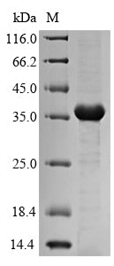Greater than 90% as determined by SDS-PAGE.Recombinant Klebsiella Pneumoniae Fimbrial Subunit Type 3 (MRKA) Protein (His-SUMO)