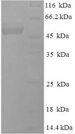 Greater than 90% as determined by SDS-PAGE.Recombinant Epstein-Barr Virus Deoxyuridine 5'-Triphosphate Nucleotidohydrolase (BLLF3) Protein (His-SUMO)